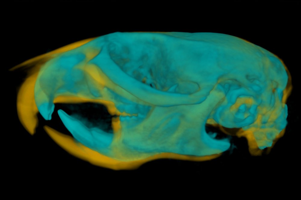 Čeští vědci objasnili nový mechanismus vzácného neurovývojového onemocnění